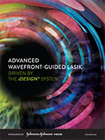 iDesign System - Advanced Wavefront-Guided Lasik