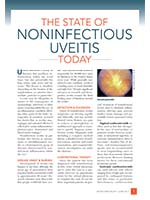 The State of Noninfectious Uveitis Today