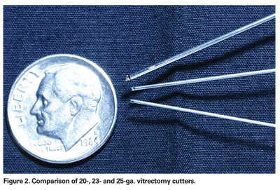 Small-Gauge Vitrectomy: The Future is Now