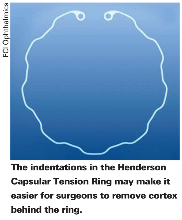 Modified Tension Rings