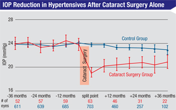 Cataract Surgery Eye Drops Chart