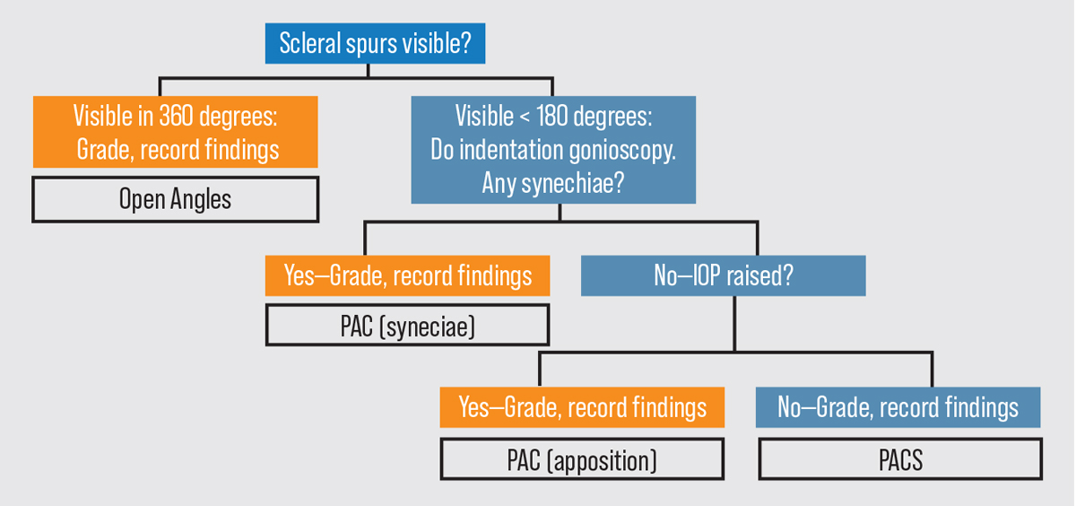  A gonioscopy flowchart for use when evaluating a patient.  Abbreviations: PAC (primary angle closure); PACS (primary angle closure suspect)