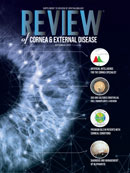 Review of Cornea & External Disease 2022